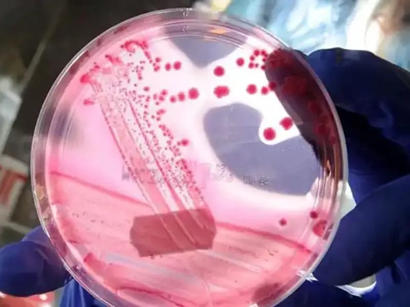 Yaşlanma Sürecini Geri Almayı Vadeden AP2A1 Proteini Keşfi