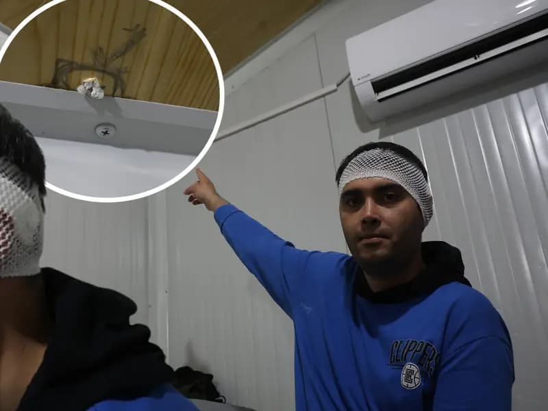 Hatay'da Yorgun Mermi İle Hayatını Kaybetmekten Döndü